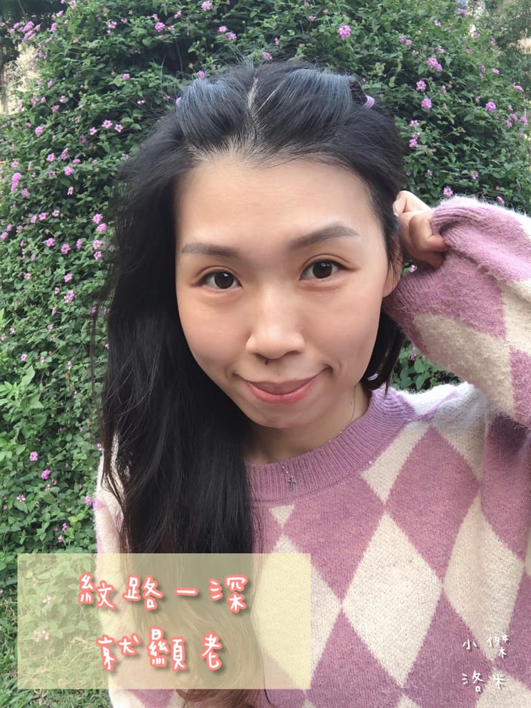 《美容》立效音波-愛爾麗診所  200條就有感 小資保養就要愛爾麗診所新北板橋店 愛美推薦 小資族福音 午休過後悄悄變美