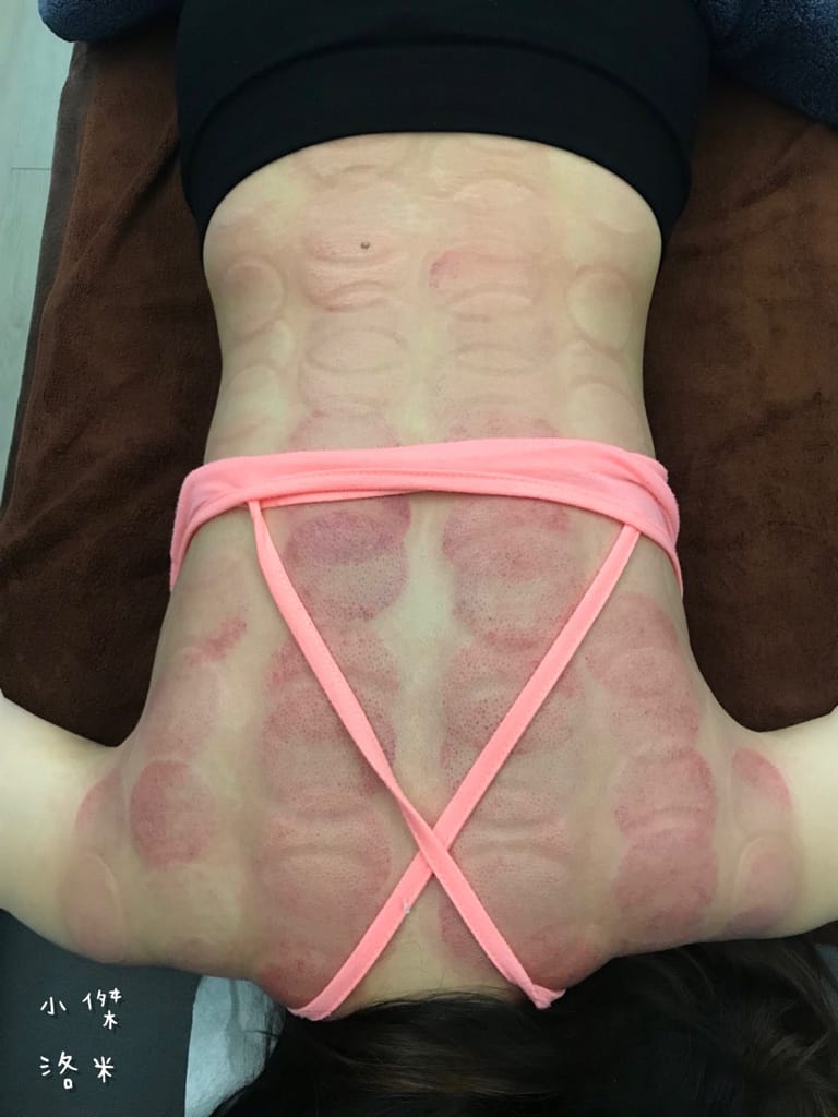 《紓壓》二訪 痠痛獵人Sore hunter | 新中式傳統整復推拿 年前大減壓 大掃除疲勞一掃而空 台北私房推薦 台北傳統整復推拿推薦