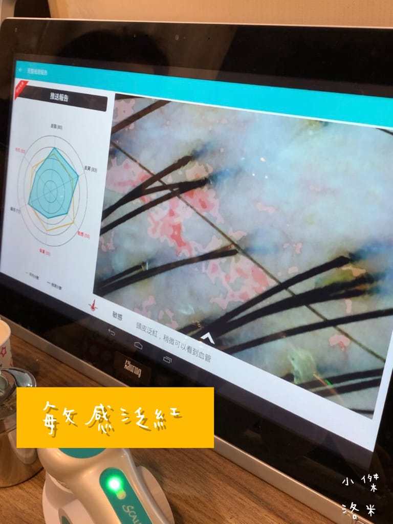 《保養》Alia&艾麗雅頭皮養護中心 ｜西門町美麗一波 專業AI頭皮檢測 用科技替頭皮說話 台北市頭皮保養推薦 護髮推薦 頭皮護理推薦