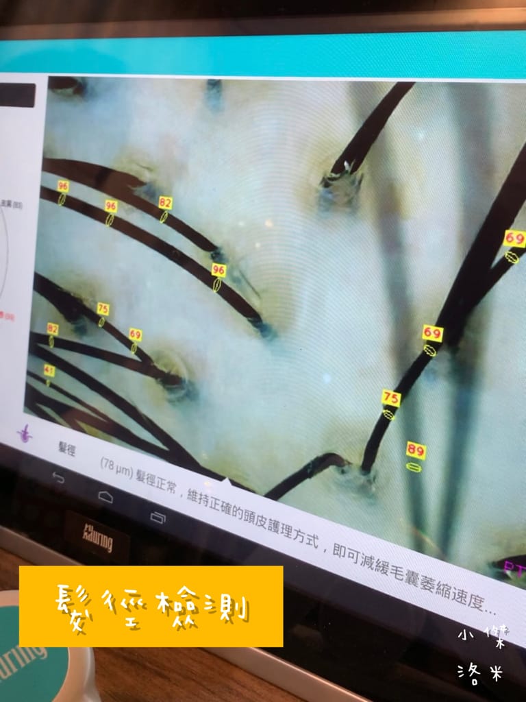 《保養》Alia&艾麗雅頭皮養護中心 ｜西門町美麗一波 專業AI頭皮檢測 用科技替頭皮說話 台北市頭皮保養推薦 護髮推薦 頭皮護理推薦