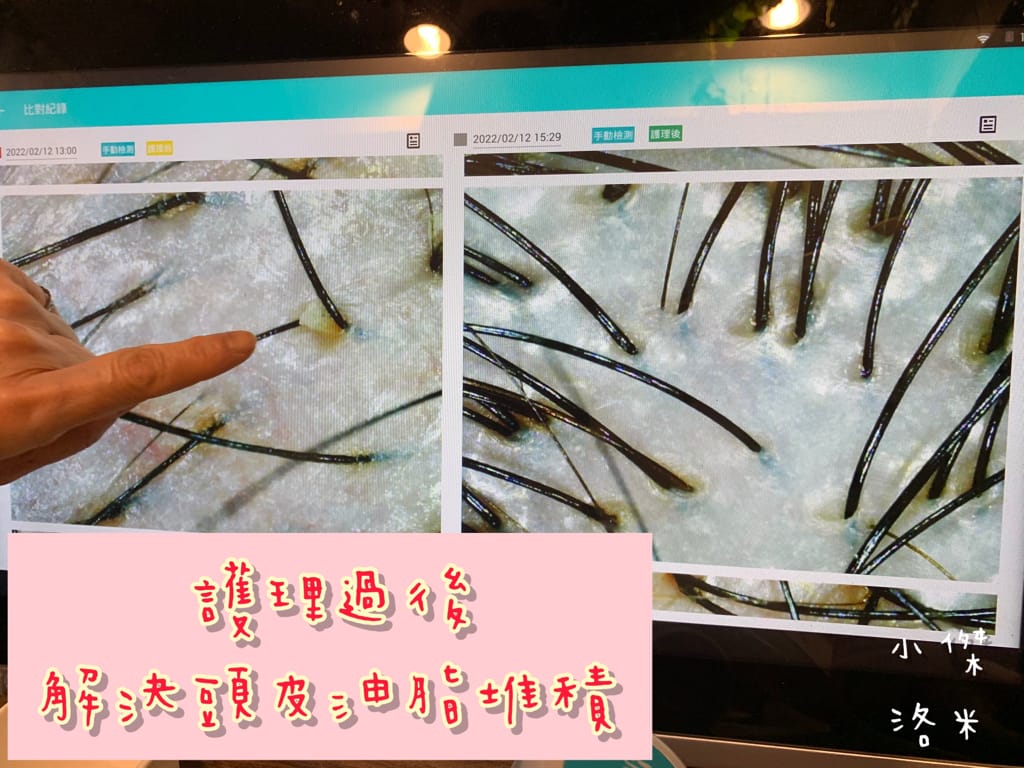 《保養》Alia&艾麗雅頭皮養護中心 ｜西門町美麗一波 專業AI頭皮檢測 用科技替頭皮說話 台北市頭皮保養推薦 護髮推薦 頭皮護理推薦