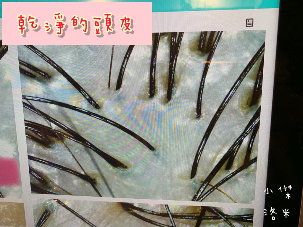 《保養》Alia&艾麗雅頭皮養護中心 ｜西門町美麗一波 專業AI頭皮檢測 用科技替頭皮說話 台北市頭皮保養推薦 護髮推薦 頭皮護理推薦