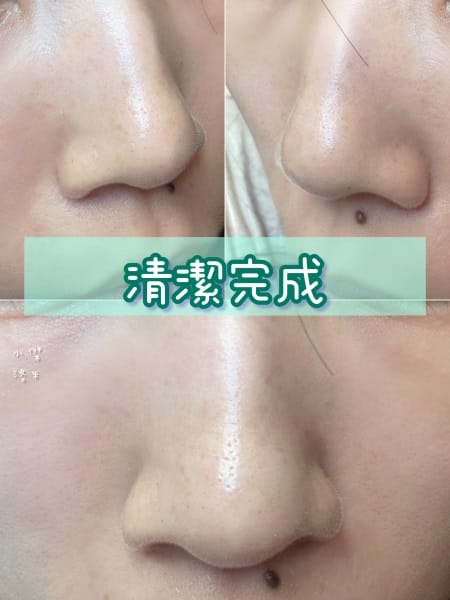 《美容》CNP粉刺分手毛孔調理安瓶｜極凈鼻膜組/毛孔調理安瓶