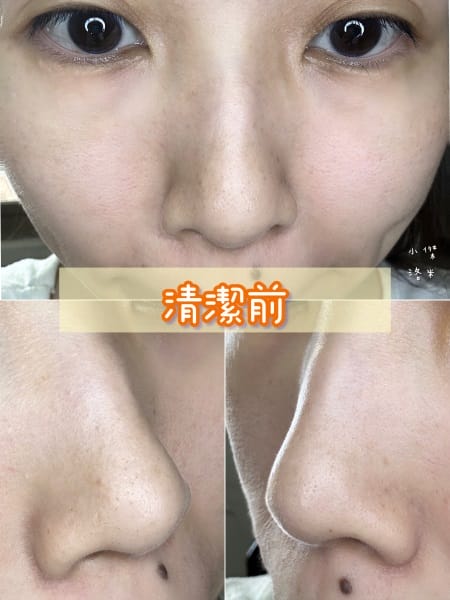 《美容》CNP粉刺分手毛孔調理安瓶｜極凈鼻膜組/毛孔調理安瓶