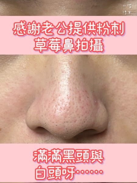 《美容》CNP粉刺分手毛孔調理安瓶｜極凈鼻膜組/毛孔調理安瓶