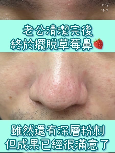 《美容》CNP粉刺分手毛孔調理安瓶｜極凈鼻膜組/毛孔調理安瓶