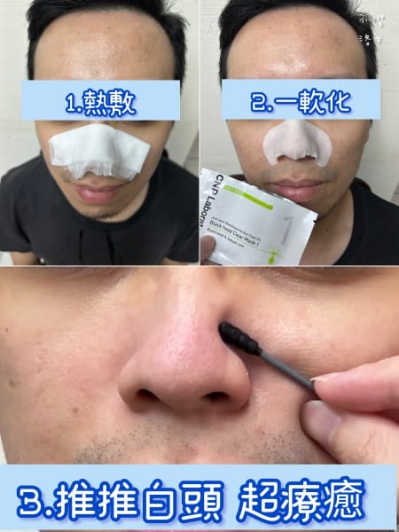 《美容》CNP粉刺分手毛孔調理安瓶｜極凈鼻膜組/毛孔調理安瓶