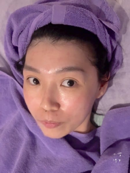 《保養》二訪愛爾麗診所｜台北蜂巢皮秒心得分享 調理毛孔與斑點