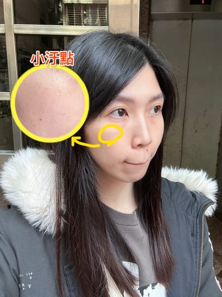 《保養》二訪愛爾麗診所｜台北蜂巢皮秒心得分享 調理毛孔與斑點